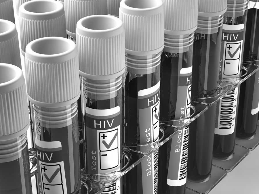 HIV-immune-deficiency-aids-homeopathy900